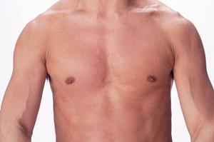 ダイエットしたいならおすすめの池袋のエステサロン