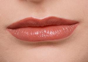 低価格で脂肪吸引の施術を受けられます